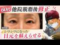 【60歳での目元整形】脱脂をした事で目元がシワシワに…💦目元レスキューで若返り🚑【ぱちキワ＋下眼瞼リフト】