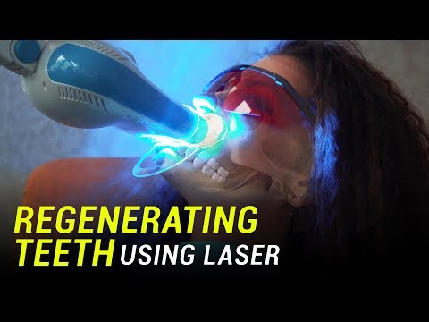 Researchers use lasers to regenerate teeth from stem cells