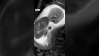 Ces Nouvelles Images Du Bebe Dans L Uterus Pourraient Sauver Des Milliers De Nouveau Nes Coin Bebe