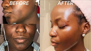 The BEST skincare routine for hyperpigmentation and fine lines | MY MORNING SKINCARE ROUTINE