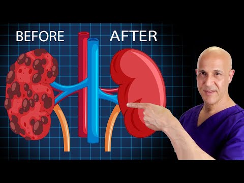 How to Heal & Cleanse Your KIDNEYS!  Dr. Mandell