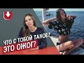 Люди с витилиго (белыми пятнами по всему телу) | Неудобные вопросы