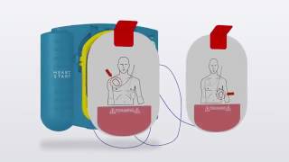 Rehabmart.com | Philips HeartStart On-Site defibrillator with Life Guidance