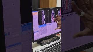 MRI L s spine scaning part 4 #radiology #hospital #xray #shortvideo #viral
