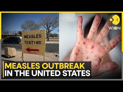 Measles Outbreak: Pennsylvania Grapples with Measles Outbreak | WION Health Matters