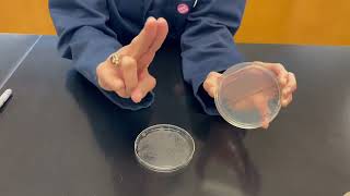 Inoculation Before And After Handwashing Plate