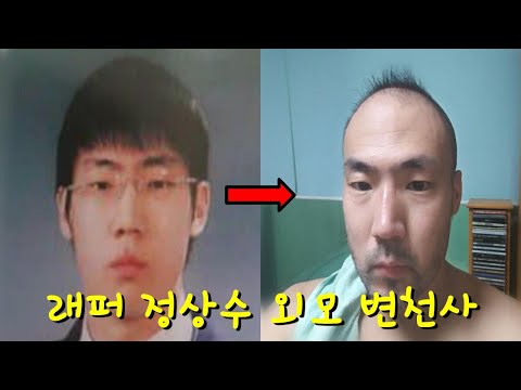 부산진구 유명가수 정상수의 탈모 변천사