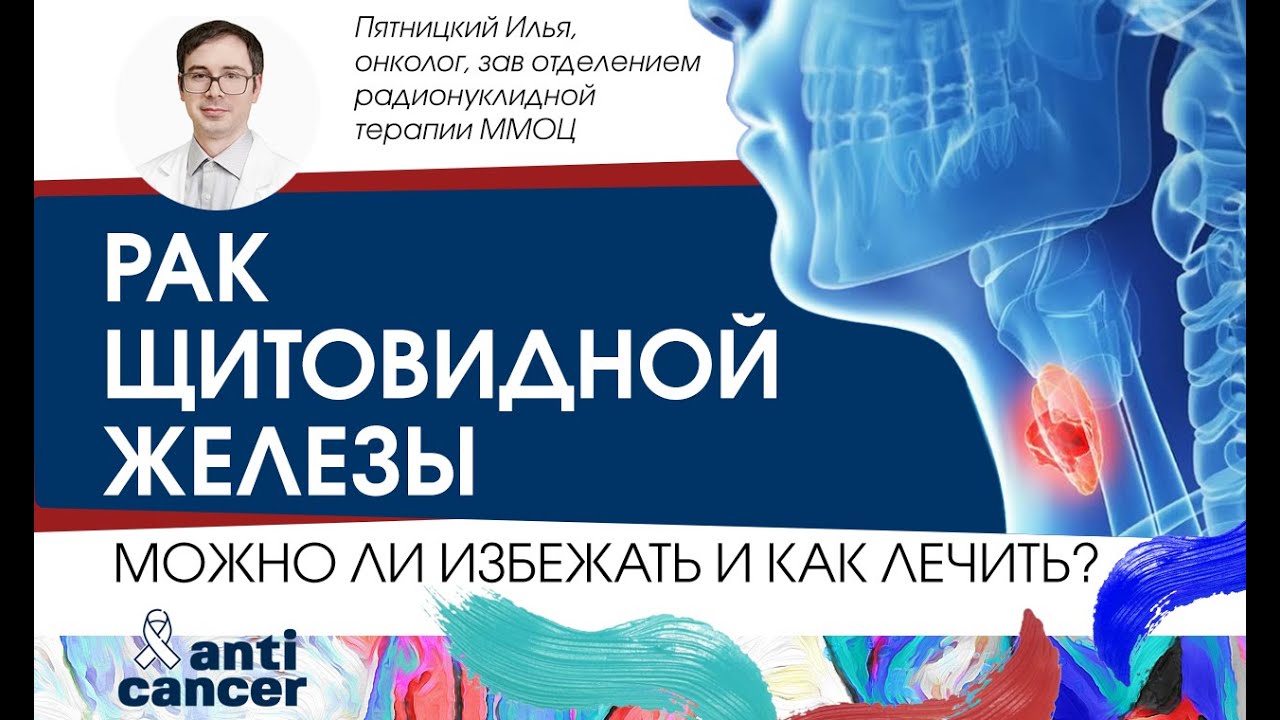 Рак щитовидной железы: можно ли избежать и как лечить?