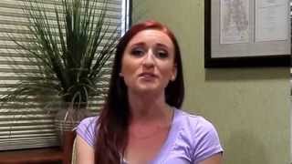 Hairline Lowering & Forehead Reduction Patient Baltimore - Dr. James E. Vogel Profile