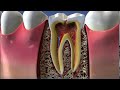 Корень Зуба 🦷 корни зубов 🩸 Стоматолог Подмосковье: Стоматология Малоярославец