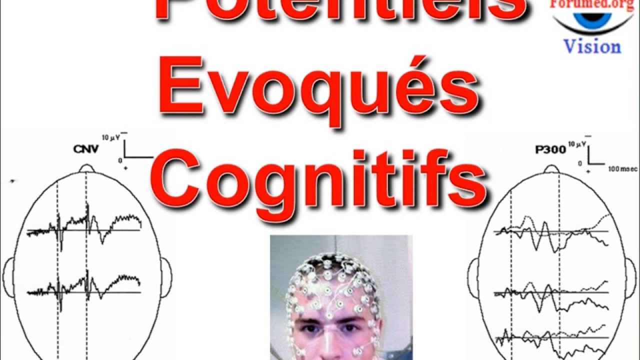 Potentiels évoqués cognitifs en Neuropsychiatrie Neuroscience Neuroanatomie fonctionnelle