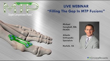 MTP Staple Compression Plates(SCP) - Webinar with Dr. Michael Campbell, MD