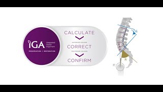 Nuvasive: iGA for Cervical