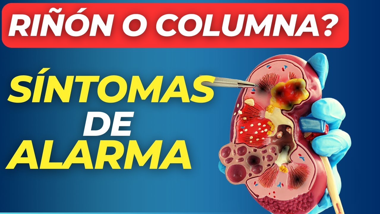 😲¡ALERTA¡ SINTOMAS de INFECCIÓN en los RIÑONES! | 😨 - YouTube