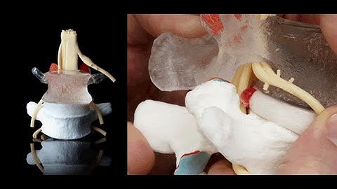 Professional LxH Model - Dynamic Disc Designs