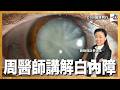 周醫師講解白內障︱醫護同行︱主持：路婉儀註冊護士  嘉賓：周醫師