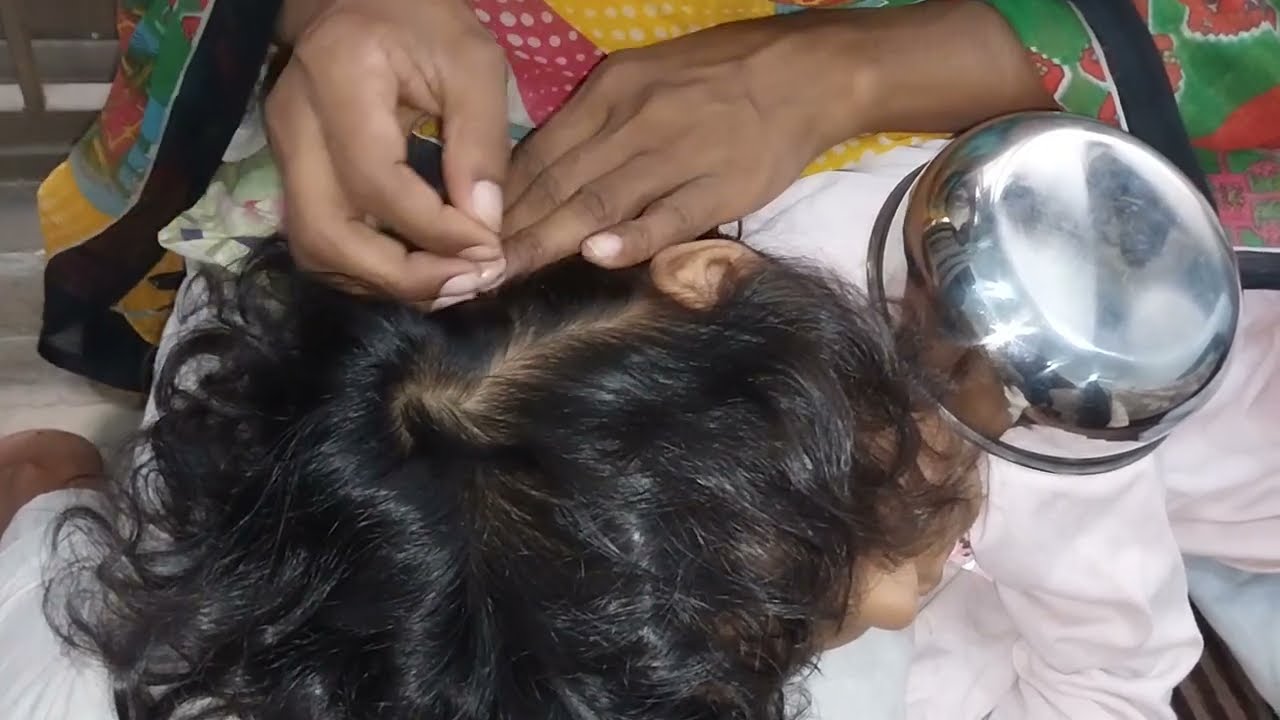 Nitpicking ASMR video 142