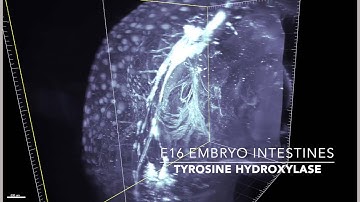 iDISCO: Dopaminergic system in the embryonic mouse