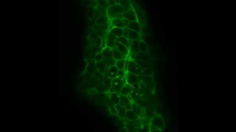 Zebrafish liver expressing membrane targeted GFP