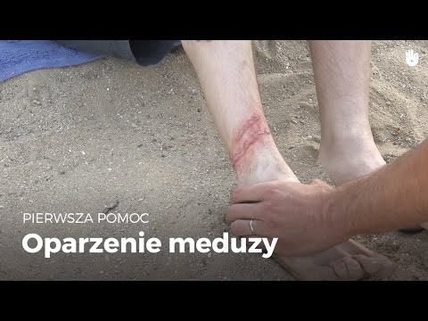 Wideo: Osa morska (meduza pudełkowa) - śmiertelny potwór morski