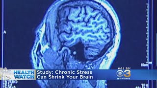 Study: Chronic Stress Can Shrink Your Brain