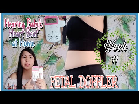 Video: Ligtas bang gamitin ang fetal doppler araw-araw?