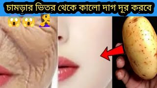 চামড়ার ভিতর থেকে মেছতার দাগ রোদে পুর কালো হয়ে যাওয়ার সমস্যা১বারে দূর করবে স্কিন ফর্সা উজ্জ্বল হবে screenshot 5