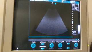 How to Install Echocardiography Machine Application Software, GE Vivid 3 Pro 4D Color Doppler screenshot 2