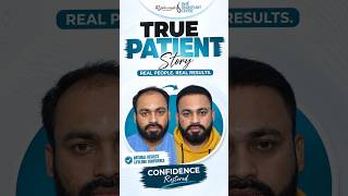 Hair Transplant in Indore | Best Results & Cost of Hair Transplant in Indore