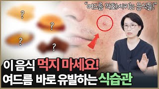 여드름 유발하는 최악의 식습관, 이 음식 먹을 때 조심하세요!