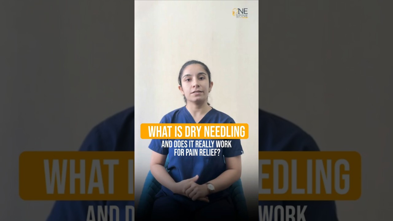 Does Dry Needling Really Work For Pain Relief? #physiotherapy