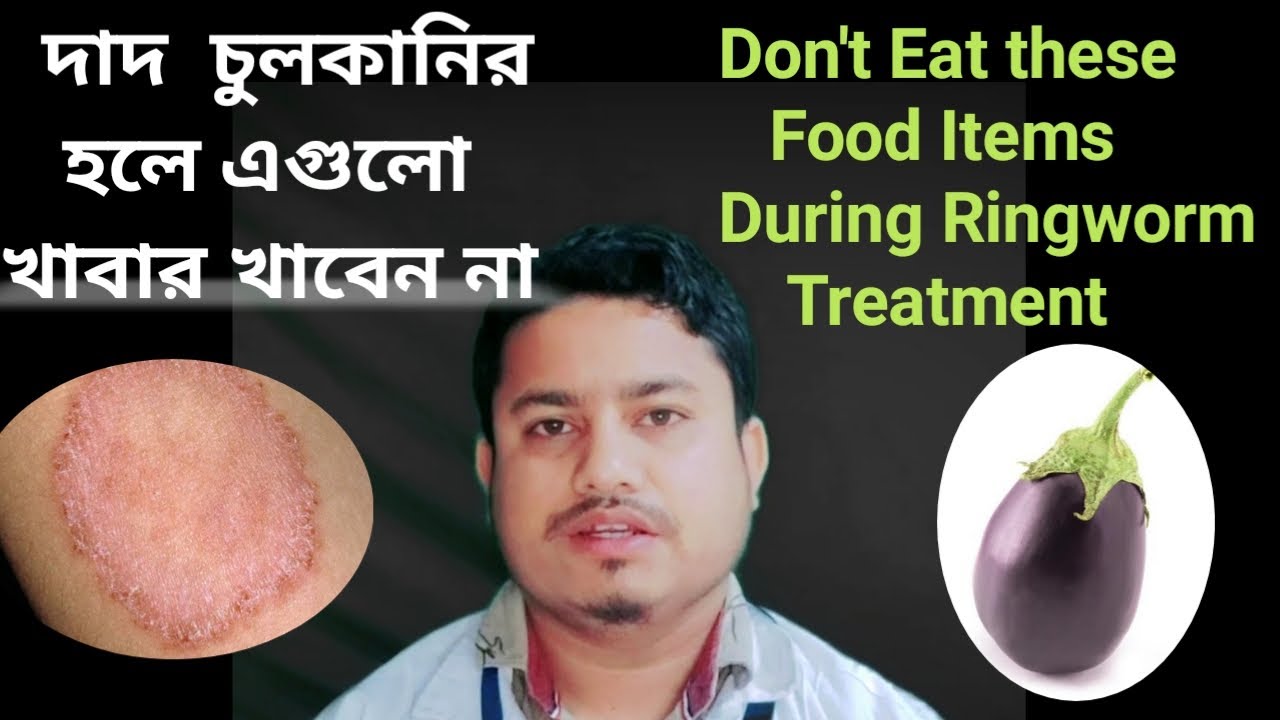 What To Avoid During Ringworm BEST GAMES WALKTHROUGH