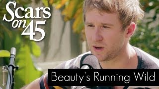 Video thumbnail of "Scars on 45 - "Beauty's Running Wild" Live Acoustic Session"