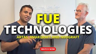Different FUE Technologies: ARTAS, SmartGraft and NeoGraft