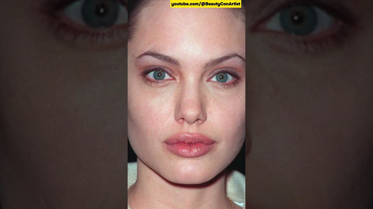 Angelina Jolie - Plastic Surgery 