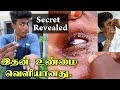 கண் வித்தை ரகசியத்தின் உண்மை வெளியானது || Eye clean in Tamil || Edison Vlogs Tamil