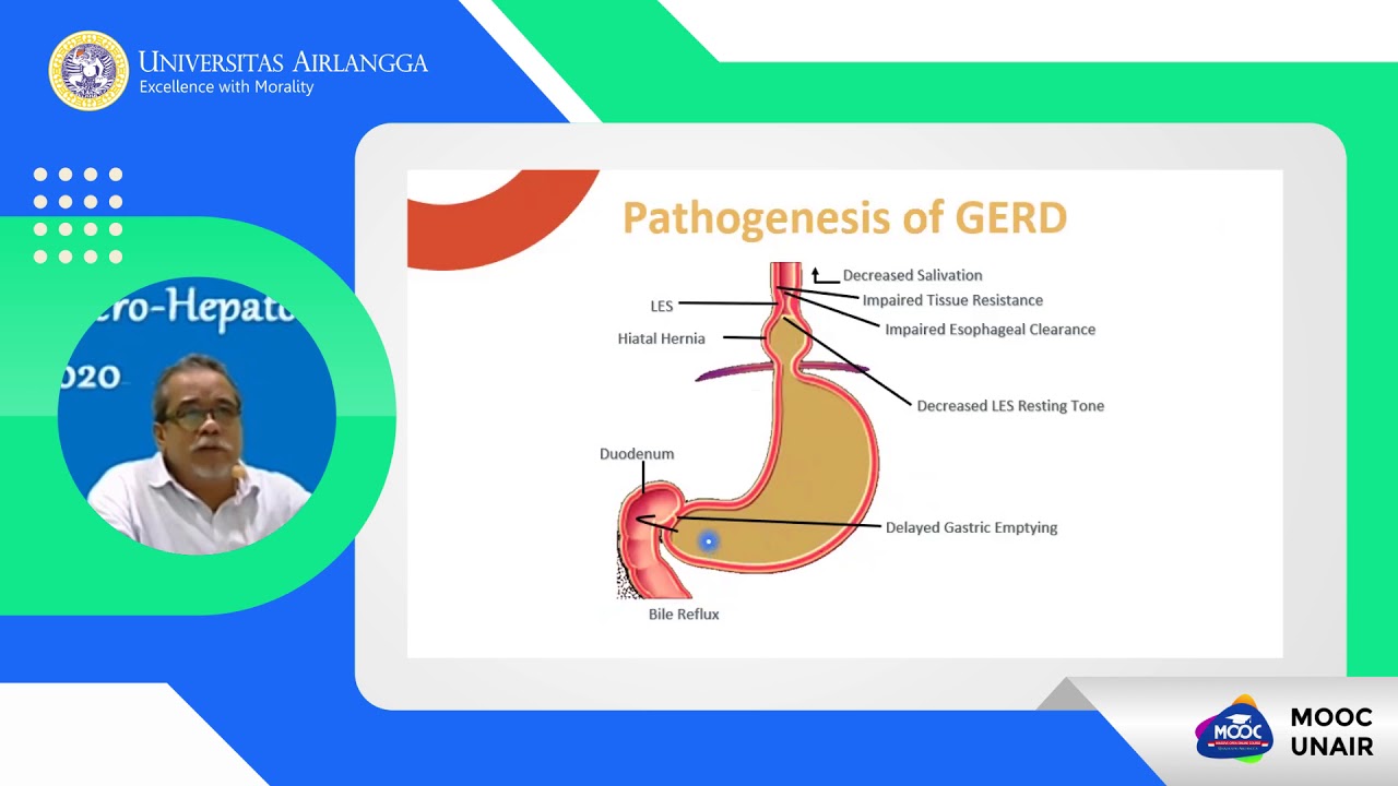 Gastroesophageal Reflux Disease (GERD)