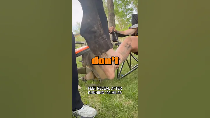 Feet After a 100 Mile Marathon (‪@BrockCovington‬)