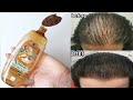 Put this ingredient in your shampoo 🌱 It speeds up hair growth and treats baldness