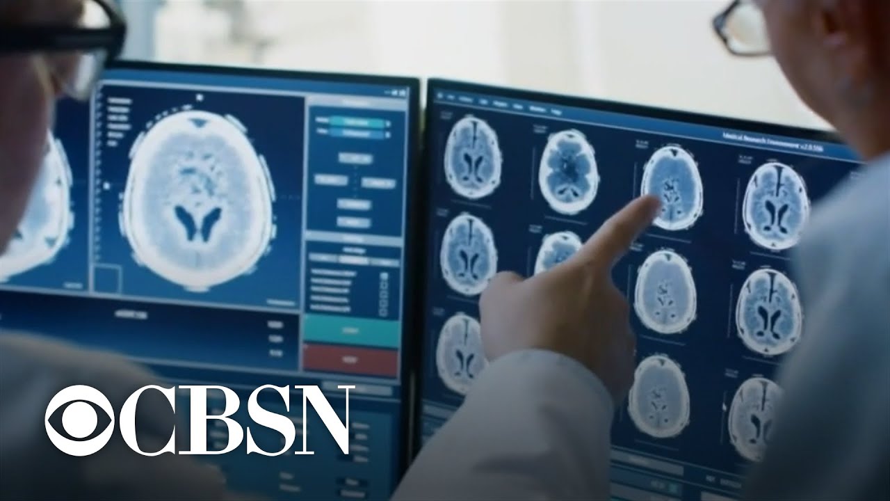 New blood test may detect more than 50 types of cancer - YouTube