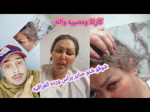 شفتو هاي الكارثة شنو صاير براس ورده العراقيه بعد الكتله
