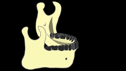 Intramembranous  Ossification