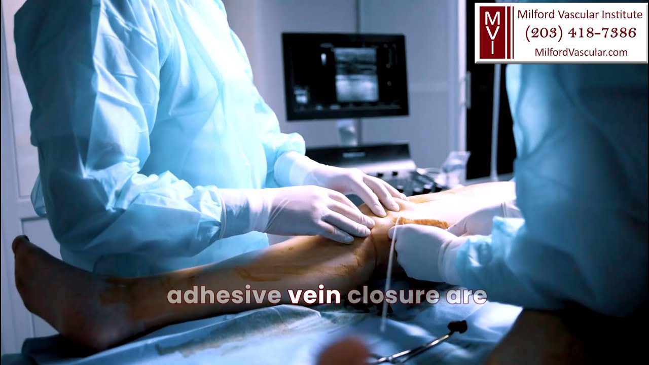 Varicose Vein Surgery Stamford CT - Is Varicose Vein Surgery Safe?