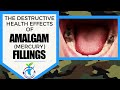 The Health Effects Of Amalgam Fillings