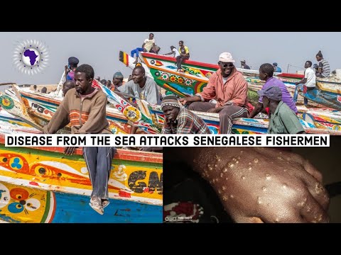 וִידֵאוֹ: 500 דייגים סנגלים שנפגעו ממחלה מסתורית לאחר שהלכו לים