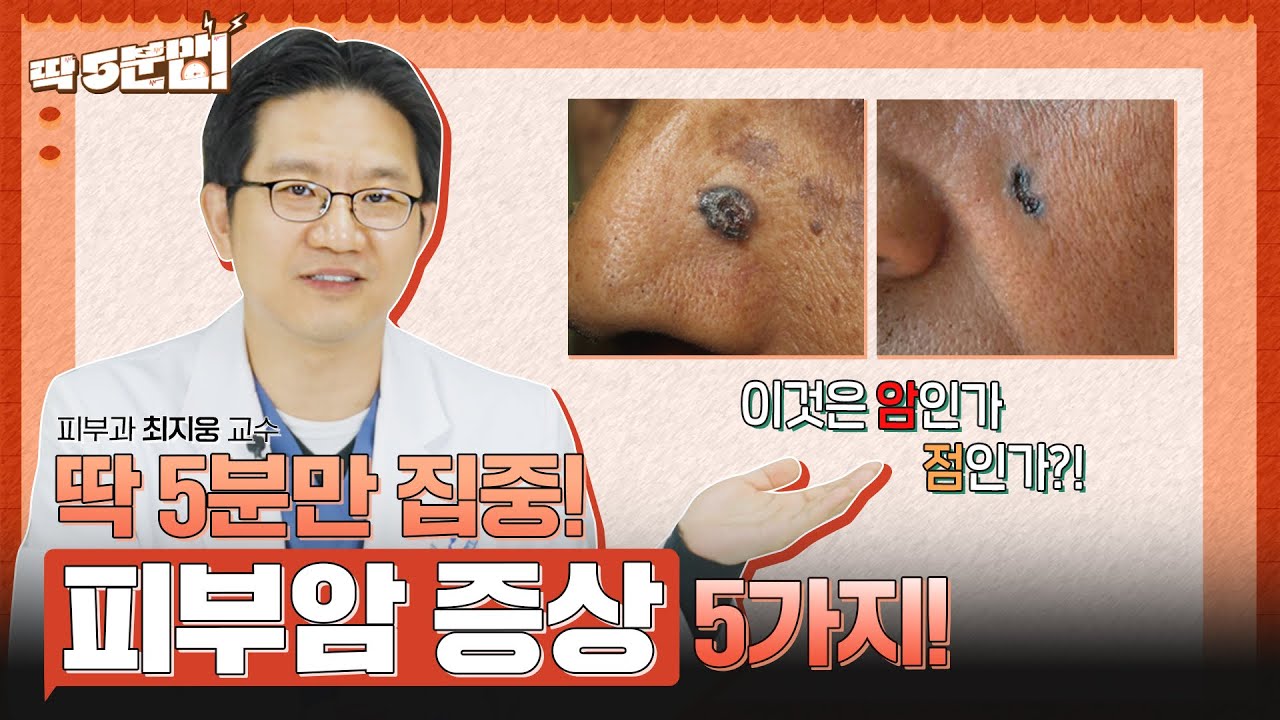 피부암 증상! 딱 5분 안에 알아보자! ⏰ 피부암을 구별할 수 있는 방법 피부과 최지웅 교수 [아주대병원TV] - YouTube