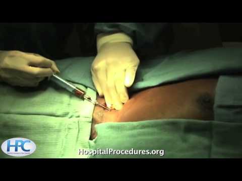 Internal Jugular Line Video procedures and processes