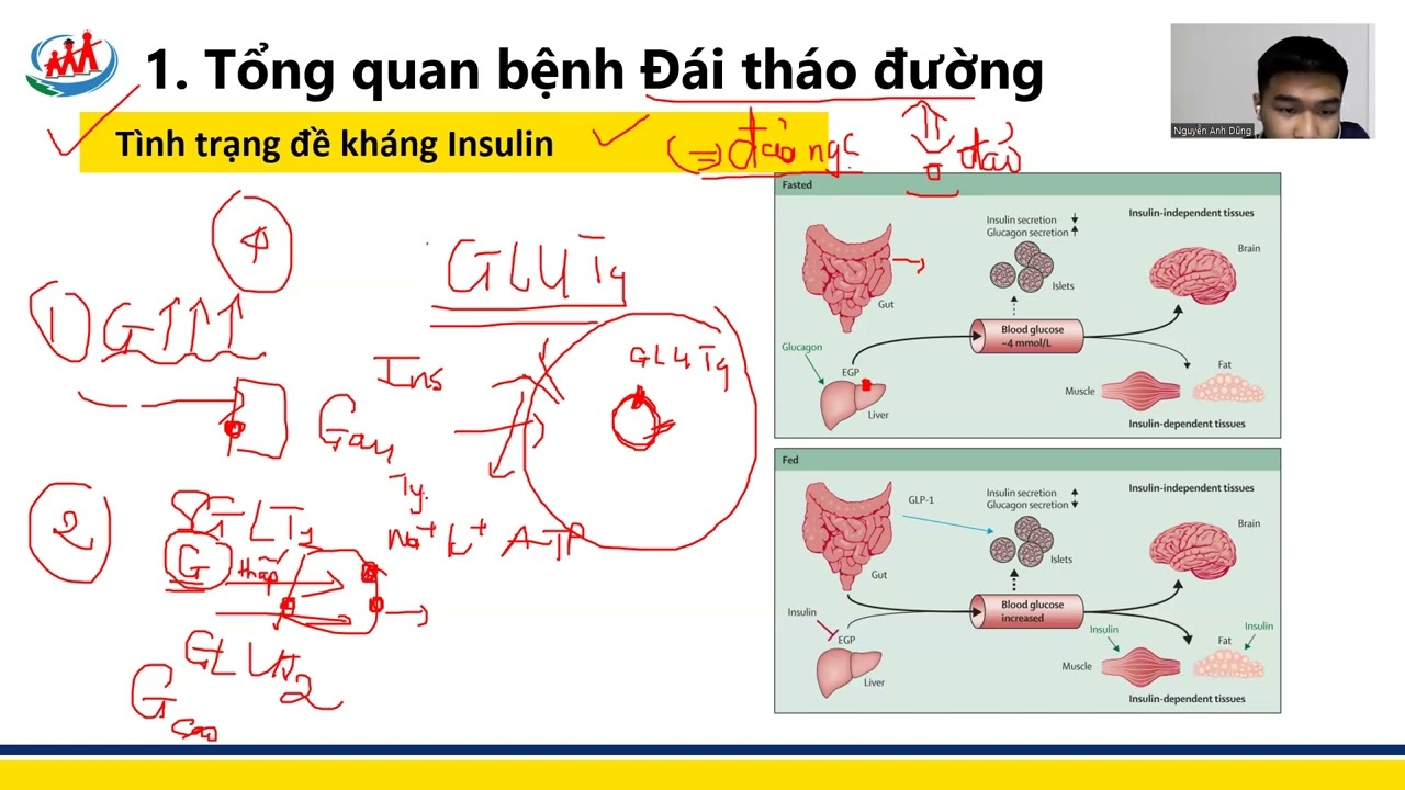 [ TIẾP CẬN ĐÁI THÁO ĐƯỜNG ]