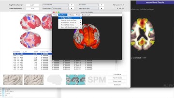 Resting state functional connectivity in CONN (#3)