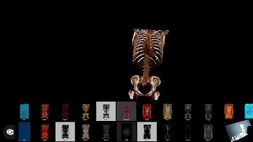 SECTRA Table ฟังก์ชั่นการใช้งาน